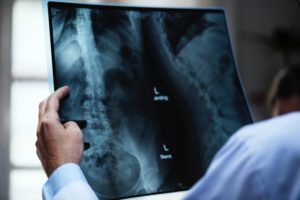 doc review xray